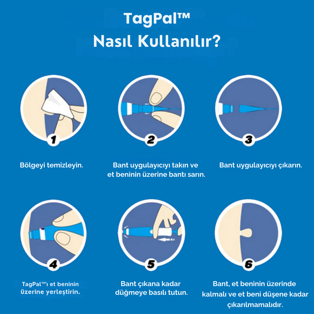 TagPal - Ben Çıkarma Kiti