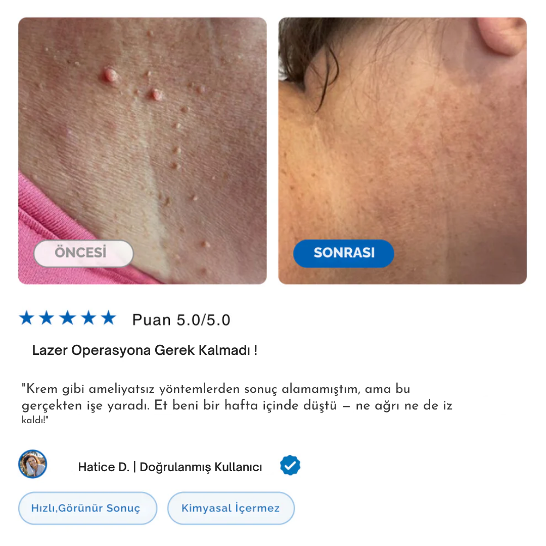 TagPal - Ben Çıkarma Kiti