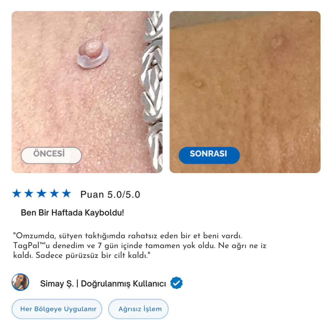 TagPal - Ben Çıkarma Kiti