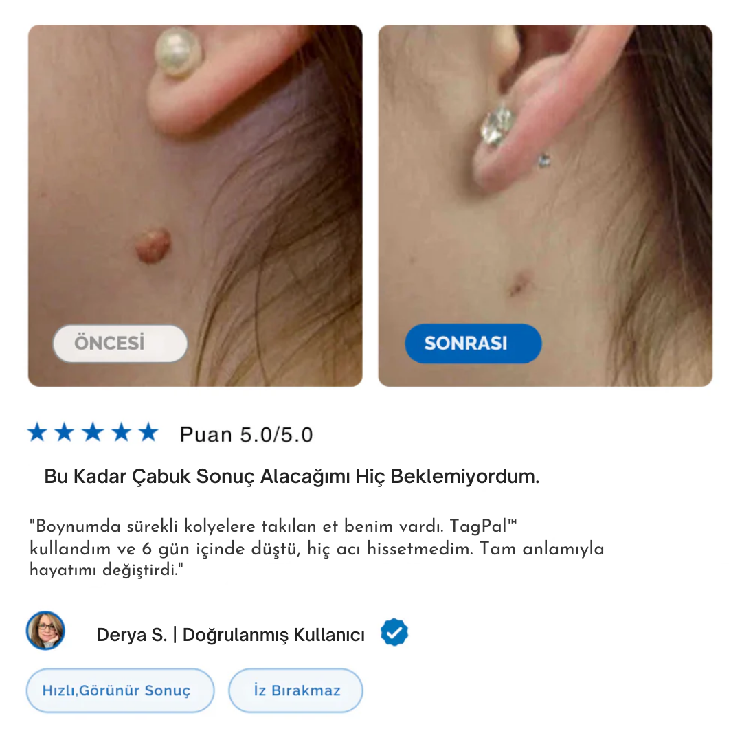 TagPal - Ben Çıkarma Kiti