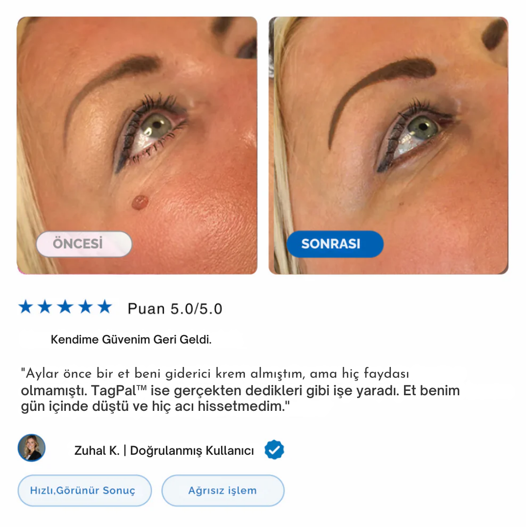 TagPal - Ben Çıkarma Kiti