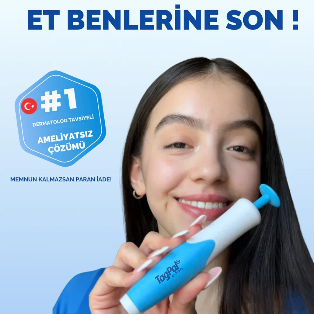 TagPal - Ben Çıkarma Kiti